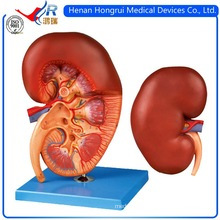 ISO Advanced Medical Kidney Model